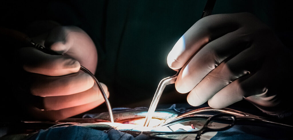 Neurocirujano operando la columna lumbar